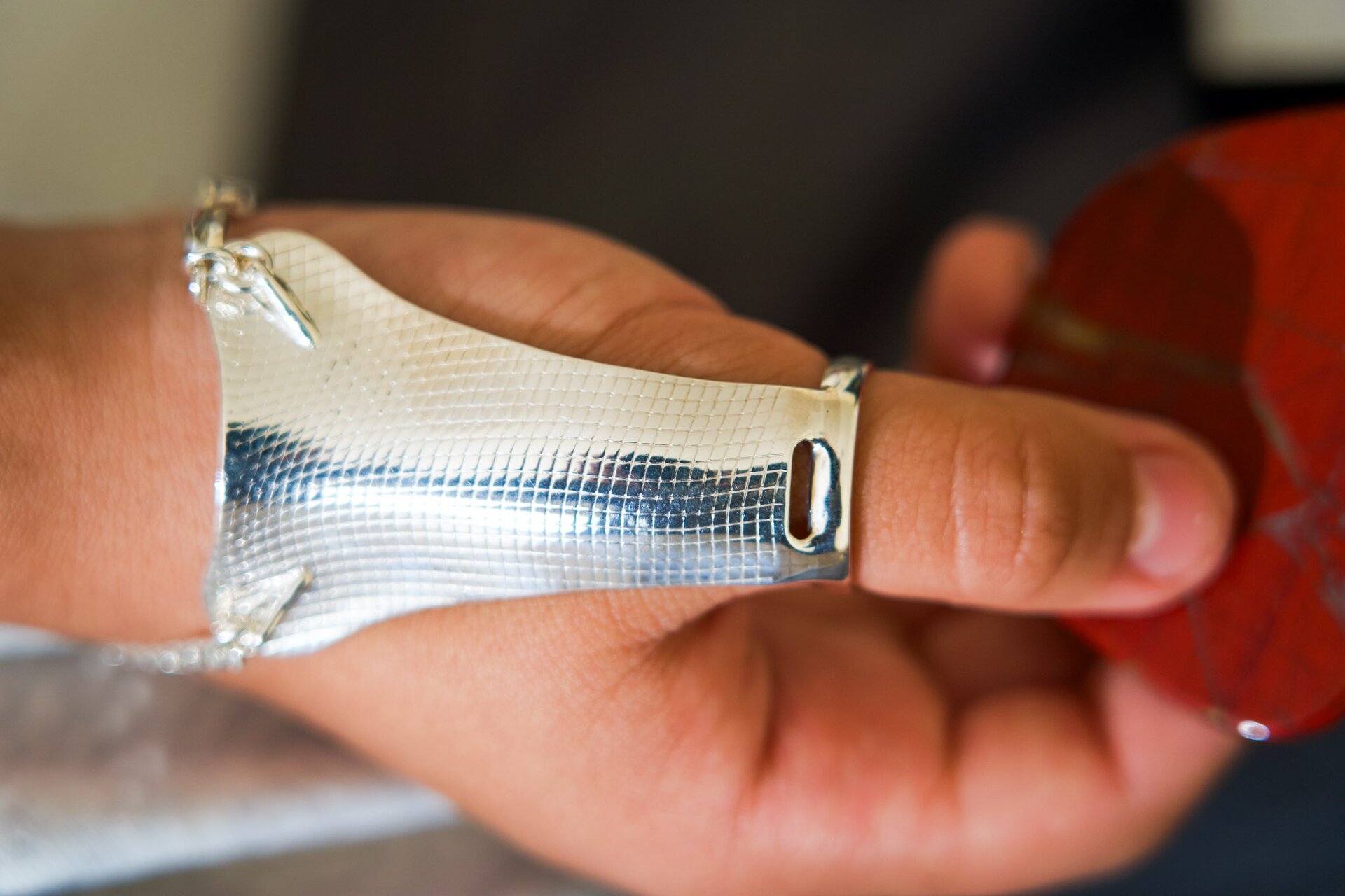 Close-up of a custom thumb splint fitted to a patient’s hand